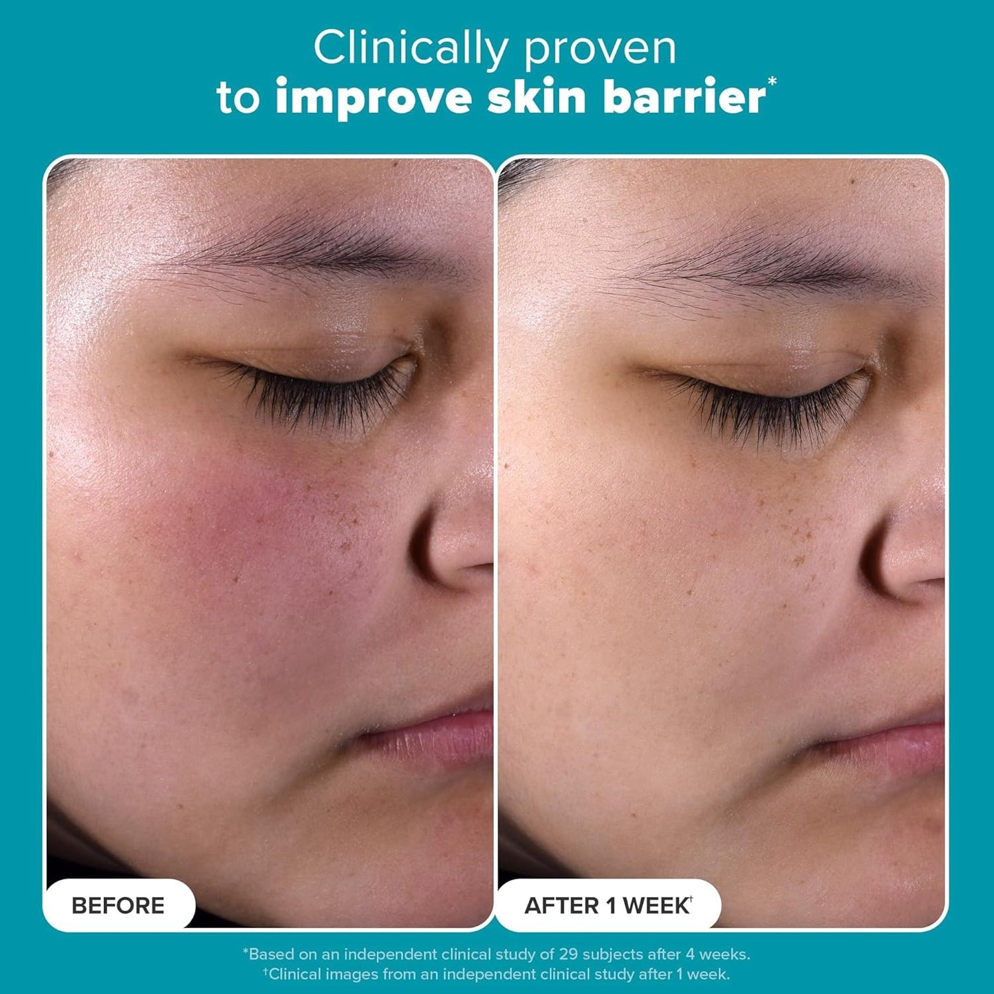 Paula's Choice Skin Perfecting 2% BHA Liquid Salicylic Acid Exfoliant
